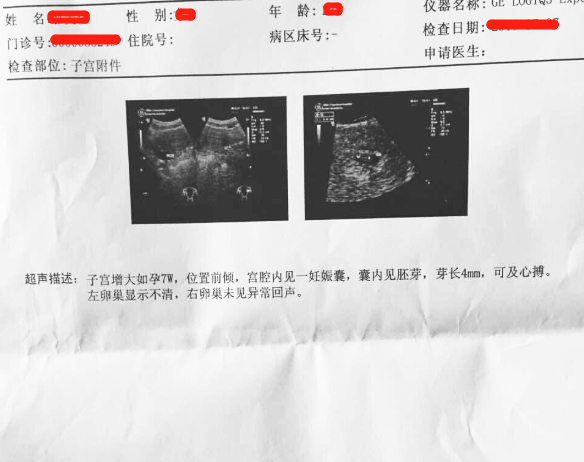 感谢北京宝贝计划助孕，挺负责的